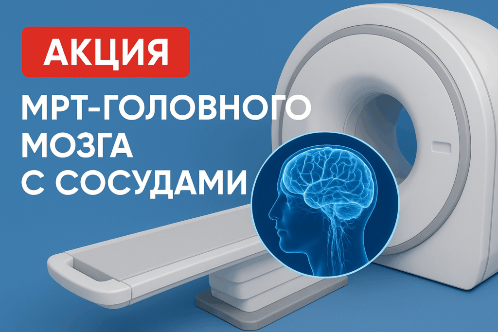 МРТ головного мозга с артериями и венами