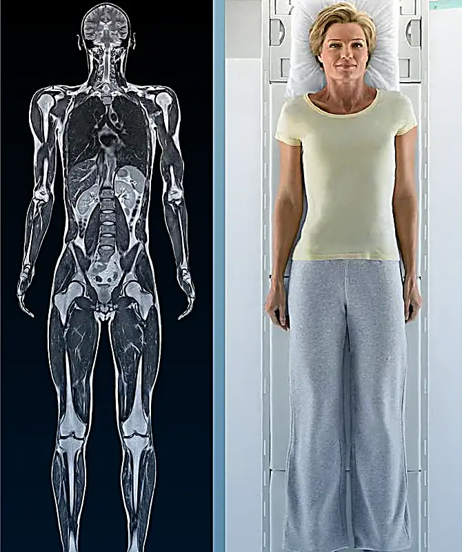 МРТ скрининг всего тела